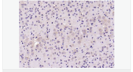 6051b2c13462a.png image.png